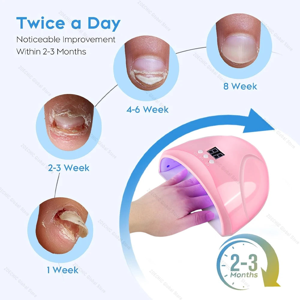 Nail Fungus Laser Treatment Device